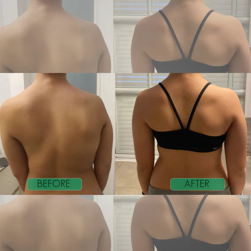 Corecare Instant Posture Corrector