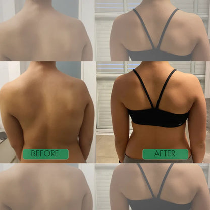 Corecare Instant Posture Corrector