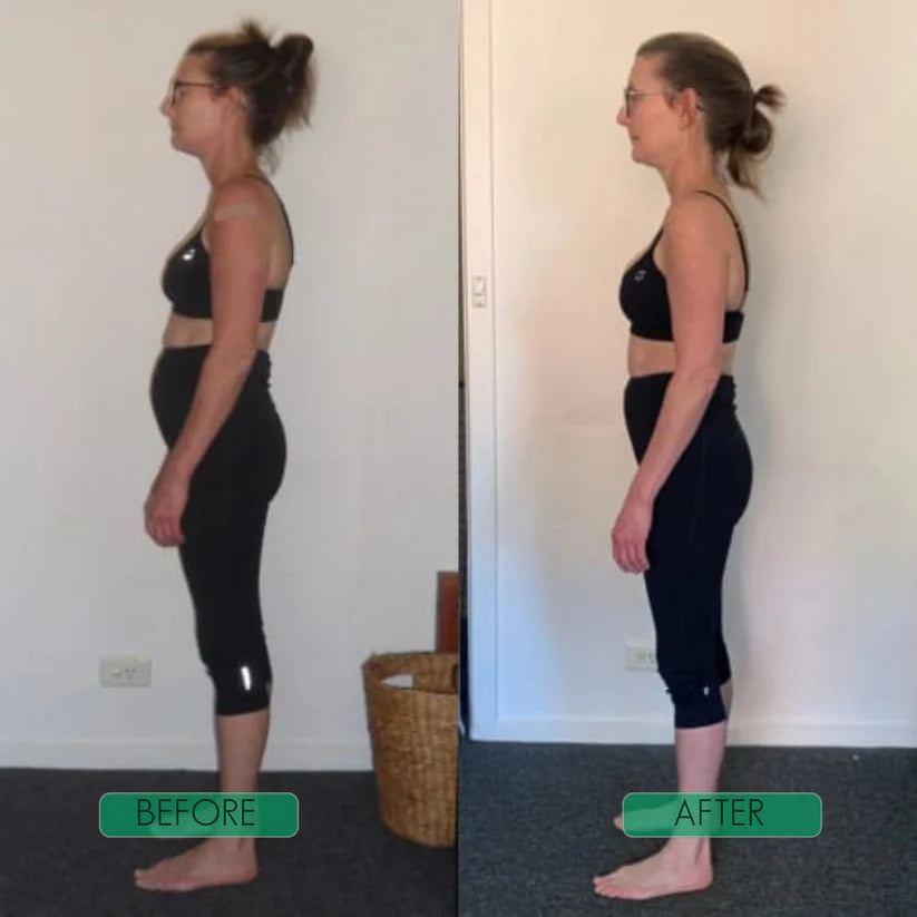 Corecare Instant Posture Corrector