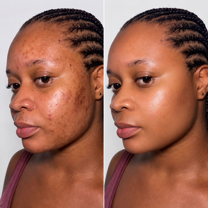 Dr Althea Melaclear Cream